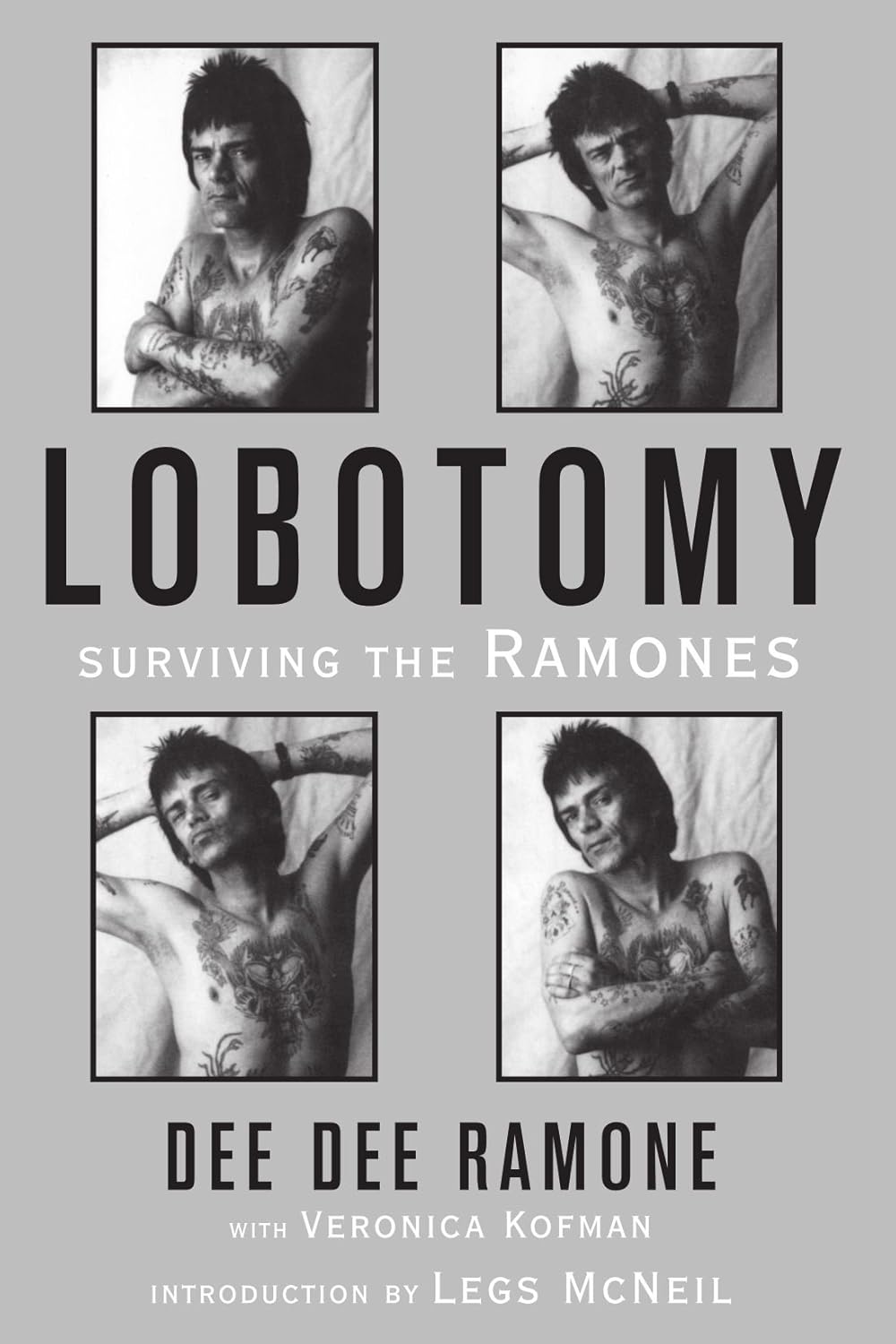 Lobotomy